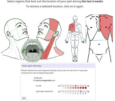 The Pain–to–Well-Being Relationship in Patients Experiencing Chronic Orofacial Pain